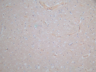 IHC image of APOE Antibody diluted at 1:100 and staining in paraffin-embedded human brain tissue performed on a Leica BondTM system. After dewaxing and hydration, antigen retrieval was mediated by high pressure in a citrate buffer (pH 6.0). Section was blocked with 10% normal goat serum 30min at RT. Then primary antibody (1% BSA) was incubated at 4°C overnight. The primary is detected by a Goat anti-rabbit polymer IgG labeled by HRP and visualized using 0.05% DAB.Rabbit anti-Human APOE Polyclonal Antibody