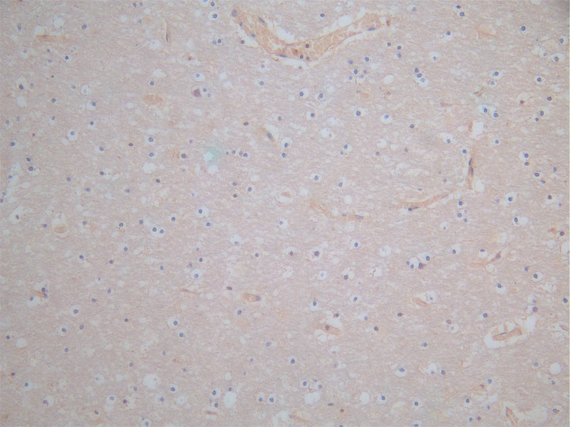 IHC image of APOE Antibody diluted at 1:100 and staining in paraffin-embedded human brain tissue performed on a Leica BondTM system. After dewaxing and hydration, antigen retrieval was mediated by high pressure in a citrate buffer (pH 6.0). Section was blocked with 10% normal goat serum 30min at RT. Then primary antibody (1% BSA) was incubated at 4°C overnight. The primary is detected by a Goat anti-rabbit polymer IgG labeled by HRP and visualized using 0.05% DAB.Rabbit anti-Human APOE Polyclonal Antibody