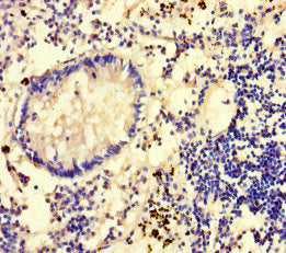 Immunohistochemistry of paraffin-embedded human appendix tissue using GLCE Antibody at dilution of 1:100Rabbit anti-Human GLCE Polyclonal Antibody