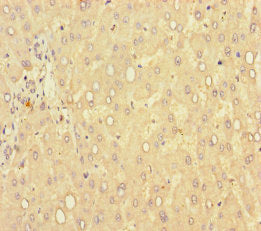 Immunohistochemistry of paraffin-embedded human liver tissue using GLCE Antibody at dilution of 1:100Rabbit anti-Human GLCE Polyclonal Antibody