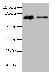 Western blot  | All lanes: GLCE antibody at 12µg/ml  | Lane 1: Rat liver tissue  | Lane 2: Mouse kidney tissue  | Secondary  | Goat polyclonal to rabbit IgG at 1/10000 dilution  | Predicted band size: 71 kDa  | Observed band size: 71 kDaRabbit anti-Human GLCE Polyclonal Antibody