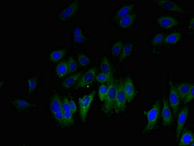 Immunofluorescent analysis of HepG2 cells using the antibody at dilution of 1:100 and Alexa Fluor 488-congugated AffiniPure Goat Anti-Rabbit IgG(H+L)Rabbit anti-Human GLIPR1 Polyclonal Antibody