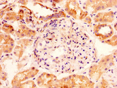 IHC image of GLIPR1 Antibody diluted at 1:100 and staining in paraffin-embedded human kidney tissue performed on a Leica BondTM system. After dewaxing and hydration, antigen retrieval was mediated by high pressure in a citrate buffer (pH 6.0). Section was blocked with 10% normal goat serum 30min at RT. Then primary antibody (1% BSA) was incubated at 4°C overnight. The primary is detected by a biotinylated secondary antibody and visualized using an HRP conjugated SP system.Rabbit anti-Human GLIPR1 Polyclonal Antibody