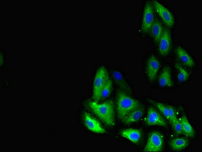 Immunofluorescent analysis of HepG2 cells using GLP1R Antibody at dilution of 1:100 and Alexa Fluor 488-congugated AffiniPure Goat Anti-Rabbit IgG(H+L)