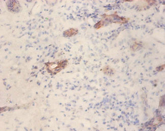 Immunohistochemistry of paraffin-embedded human pancreatic tissue using GLP1R Antibody at dilution of 1:100