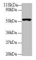 Western blot  | All lanes: GLP1R antibody at 2µg/ml + 293T whole cell lysate  | Secondary  | Goat polyclonal to rabbit IgG at 1/10000 dilution  | Predicted band size: 54 kDa  | Observed band size: 54 kDa