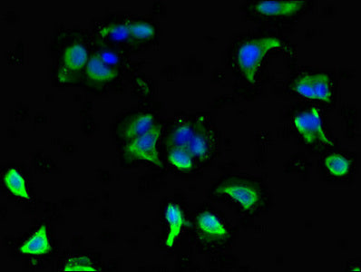 Immunofluorescent analysis of MCF-7 cells using GLRA1 Antibody at dilution of 1:100 and Alexa Fluor 488-congugated AffiniPure Goat Anti-Rabbit IgG(H+L)Rabbit anti-Human GLRA1 Polyclonal Antibody