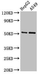 Western Blot | Positive WB detected in: HepG2 whole cell lysate, A549 whole cell lysate | All lanes: GLRA1 antibody at 2.7μg/ml | Secondary | Goat polyclonal to rabbit IgG at 1/50000 dilution | Predicted band size: 53, 52 kDa | Observed band size: 53 kDaRabbit anti-Human GLRA1 Polyclonal Antibody