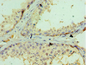 Immunohistochemistry of paraffin-embedded human testis tissue using GLRX3 Antibody at dilution of 1:100Rabbit anti-Human GLRX3 Polyclonal Antibody