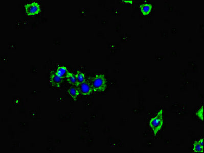 Immunofluorescent analysis of HepG2 cells using GLUL Antibody at dilution of 1:100 and Alexa Fluor 488-congugated AffiniPure Goat Anti-Rabbit IgG(H+L)Rabbit anti-Human GLUL Polyclonal Antibody
