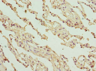 Immunohistochemistry of paraffin-embedded human lung tissue using GLYCTK Antibody at dilution of 1:100Rabbit anti-Human GLYCTK Polyclonal Antibody