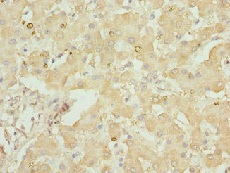 Immunohistochemistry of paraffin-embedded human liver tissue using GLYCTK Antibody at dilution of 1:100Rabbit anti-Human GLYCTK Polyclonal Antibody