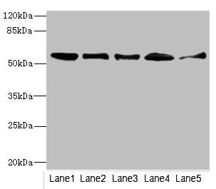 Western blot | All lanes: GLYCTKantibody at 5.43μg/ml | Lane 1: Mouse liver tissue | Lane 2: Mouse lung tissue | Lane 3: Mouse kidney tissue | Lane 4: Rat lung tissue | Lane 5: NIH/3T3 whole cell lysate | Secondary | Goat polyclonal to rabbit IgG at 1/10000 dilution | Predicted band size: 56, 26, 49, 39, 20, 23 kDa | Observed band size: 56 kDaRabbit anti-Human GLYCTK Polyclonal Antibody