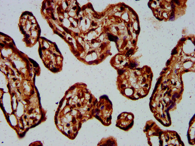 IHC image of GNA12 Antibody diluted at 1:400 and staining in paraffin-embedded human placenta tissue performed on a Leica BondTM system. After dewaxing and hydration, antigen retrieval was mediated by high pressure in a citrate buffer (pH 6.0). Section was blocked with 10% normal goat serum 30min at RT. Then primary antibody (1% BSA) was incubated at 4°C overnight. The primary is detected by a biotinylated secondary antibody and visualized using an HRP conjugated SP system.Rabbit anti-Human GNA12 Polyclonal Antibody