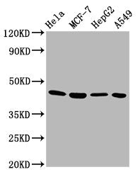 Western Blot  | Positive WB detected in: Hela whole cell lysate, MCF-7 whole cell lysate, HepG2 whole cell lysate, A549 whole cell lysate  | All lanes: GNA12 antibody at 5.8µg/ml  | Secondary  | Goat polyclonal to rabbit IgG at 1/50000 dilution  | Predicted band size: 45, 38, 35 kDa  | Observed band size: 45 kDaRabbit anti-Human GNA12 Polyclonal Antibody