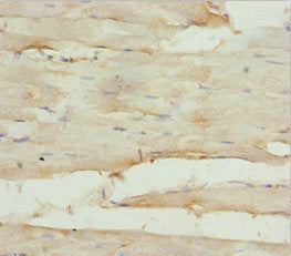 Immunohistochemistry of paraffin-embedded human skeletal muscle tissue using GNA15 Antibody at dilution of 1:100Rabbit anti-Human GNA15 Polyclonal Antibody