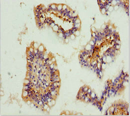Immunohistochemistry of paraffin-embedded human small intestine tissue using GNA15 Antibody at dilution of 1:100Rabbit anti-Human GNA15 Polyclonal Antibody