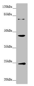 Western blot | All lanes: GNA15 antibody at 1.41 μg/ml + Mouse liver tissue | Secondary | Goat polyclonal to rabbit IgG at 1/10000 dilution | Predicted band size: 44 kDa | Observed band size: 44, 24, 72 kDaRabbit anti-Human GNA15 Polyclonal Antibody