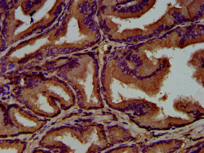 IHC image of GNAL Antibody diluted at 1:500 and staining in paraffin-embedded human prostate tissue performed on a Leica BondTM system. After dewaxing and hydration, antigen retrieval was mediated by high pressure in a citrate buffer (pH 6.0). Section was blocked with 10% normal goat serum 30min at RT. Then primary antibody (1% BSA) was incubated at 4°C overnight. The primary is detected by a biotinylated secondary antibody and visualized using an HRP conjugated SP system.Rabbit anti-Human GNAL Polyclonal Antibody