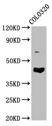 Western Blot  | Positive WB detected in: Colo320 whole cell lysate  | All lanes: GNAL antibody at 4.8µg/ml  | Secondary  | Goat polyclonal to rabbit IgG at 1/50000 dilution  | Predicted band size: 45, 53, 21 kDa  | Observed band size: 45 kDaRabbit anti-Human GNAL Polyclonal Antibody