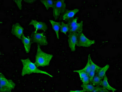 Immunofluorescent analysis of Hela cells using GNAT1 Antibody at dilution of 1:100 and Alexa Fluor 488-congugated AffiniPure Goat Anti-Rabbit IgG(H+L)Rabbit anti-Human GNAT1 Polyclonal Antibody