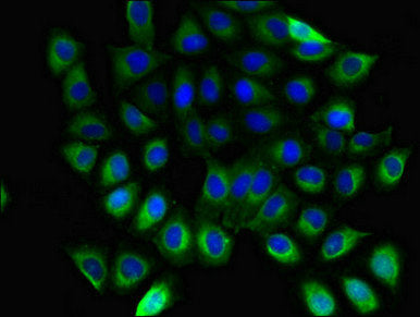 Immunofluorescent analysis of A549 cells using GNB5 Antibody at dilution of 1:100 and Alexa Fluor 488-congugated AffiniPure Goat Anti-Rabbit IgG(H+L)Rabbit anti-Human GNB5 Polyclonal Antibody