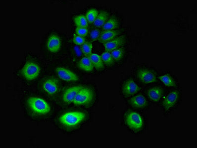 Immunofluorescent analysis of A549 cells using GNG10 Antibody at dilution of 1:100 and Alexa Fluor 488-congugated AffiniPure Goat Anti-Rabbit IgG(H+L)Rabbit anti-Human GNG10 Polyclonal Antibody