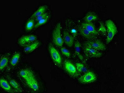 Immunofluorescent analysis of HepG2 cells using GNG11 Antibody at dilution of 1:100 and Alexa Fluor 488-congugated AffiniPure Goat Anti-Rabbit IgG(H+L)Rabbit anti-Human GNG11 Polyclonal Antibody