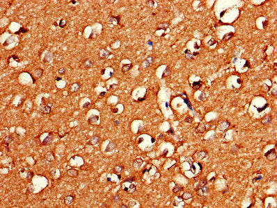 Immunohistochemistry of paraffin-embedded human brain tissue using the antibody at dilution of 1:100Rabbit anti-Human GNG11 Polyclonal Antibody