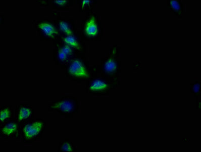 Immunofluorescence staining of U251 cells with GNG2 Antibody at 1:50, counter-stained with DAPI. The cells were fixed in 4% formaldehyde, permeabilized using 0.2% Triton X-100 and blocked in 10% normal Goat Serum. The cells were then incubated with the antibody overnight at 4°C. The secondary antibody was Alexa Fluor 488-congugated AffiniPure Goat Anti-Rabbit IgG(H+L).Rabbit anti-Human GNG2 Polyclonal Antibody
