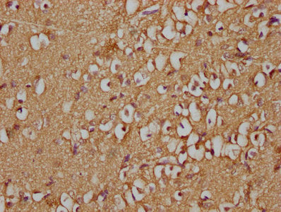 IHC image of GNG2 Antibody diluted at 1:100 and staining in paraffin-embedded human brain tissue performed on a Leica BondTM system. After dewaxing and hydration, antigen retrieval was mediated by high pressure in a citrate buffer (pH 6.0). Section was blocked with 10% normal goat serum 30min at RT. Then primary antibody (1% BSA) was incubated at 4°C overnight. The primary is detected by a biotinylated secondary antibody and visualized using an HRP conjugated SP system.Rabbit anti-Human GNG2 Polyclonal Antibody