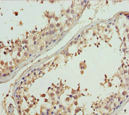 Immunohistochemistry of paraffin-embedded human testis tissue using GNS Antibody at dilution of 1:100Rabbit anti-Human GNS Polyclonal Antibody