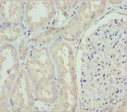 Immunohistochemistry of paraffin-embedded human kidney tissue using GNS Antibody at dilution of 1:100Rabbit anti-Human GNS Polyclonal Antibody