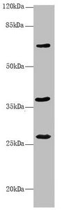 Western blot | All lanes: GNS antibody at 3.61 μg/ml + Mouse liver tissue | Secondary | Goat polyclonal to rabbit IgG at 1/10000 dilution | Predicted band size: 63, 60 kDa | Observed band size: 63, 27, 37 kDaRabbit anti-Human GNS Polyclonal Antibody