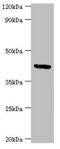 Western blot | All lanes: Golgi membrane protein 1 antibody at 7μg/ml + Hela whole cell lysate | Secondary | Goat polyclonal to rabbit IgG at 1/10000 dilution | Predicted band size: 46, 45 kDa | Observed band size: 46 kDaRabbit anti-Human GOLM1 Polyclonal Antibody
