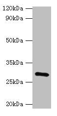 Western blot | All lanes: GOSR1 antibody at 16μg/ml + Mouse liver tissue | Secondary | Goat polyclonal to rabbit IgG at 1/10000 dilution | Predicted band size: 29, 22 kDa | Observed band size: 29 kDaRabbit anti-Human GOSR1 Polyclonal Antibody