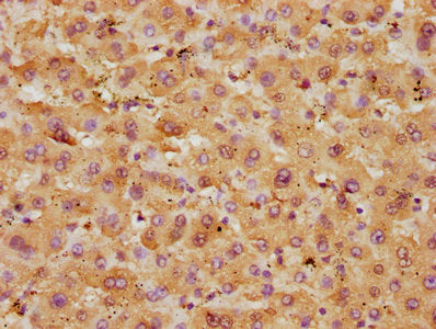IHC image of GOT1 Antibody diluted at 1:250 and staining in paraffin-embedded human liver tissue performed on a Leica BondTM system. After dewaxing and hydration, antigen retrieval was mediated by high pressure in a citrate buffer (pH 6.0). Section was blocked with 10% normal goat serum 30min at RT. Then primary antibody (1% BSA) was incubated at 4°C overnight. The primary is detected by a biotinylated secondary antibody and visualized using an HRP conjugated SP system.Rabbit anti-Human GOT1 Polyclonal Antibody
