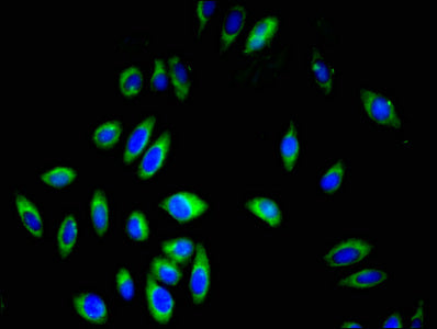 Immunofluorescent analysis of A549 cells using GP9 Antibody at dilution of 1:100 and Alexa Fluor 488-congugated AffiniPure Goat Anti-Rabbit IgG(H+L)Rabbit anti-Human GP9 Polyclonal Antibody