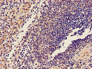 Immunohistochemistry of paraffin-embedded human spleen tissue using GP9 Antibody at dilution of 1:100Rabbit anti-Human GP9 Polyclonal Antibody