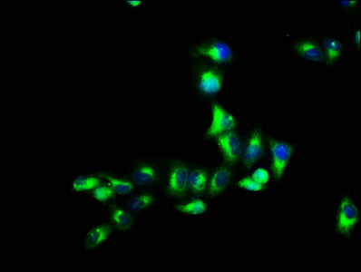 Immunofluorescence staining of Hela cells with GPR12 Antibody at 1:66, counter-stained with DAPI. The cells were fixed in 4% formaldehyde, permeabilized using 0.2% Triton X-100 and blocked in 10% normal Goat Serum. The cells were then incubated with the antibody overnight at 4°C. The secondary antibody was Alexa Fluor 488-congugated AffiniPure Goat Anti-Rabbit IgG(H+L).Rabbit anti-Human GPR12 Polyclonal Antibody