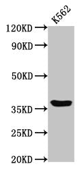 Western Blot  | Positive WB detected in: K562 whole cell lysate  | All lanes: GPR12 antibody at 2µg/ml  | Secondary  | Goat polyclonal to rabbit IgG at 1/50000 dilution  | Predicted band size: 37 kDa  | Observed band size: 37 kDaRabbit anti-Human GPR12 Polyclonal Antibody