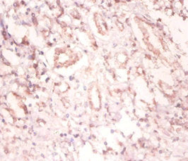 Immunohistochemistry of paraffin-embedded human kidney tissue using the antibody at dilution of 1:100Rabbit anti-Human SNRPA Polyclonal Antibody
