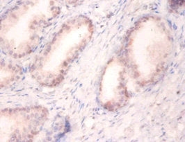 Immunohistochemistry of paraffin-embedded human prostate tissue using SNRPA Antibody at dilution of 1:100Rabbit anti-Human SNRPA Polyclonal Antibody