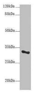 Western blot  | All lanes:SNRPA antibody at 9μg/ml + Mouse liver tissue  | Secondary  | Goat polyclonal to rabbit IgG at 1/10000 dilution  | Predicted band size: 31 kDa  | Observed band size: 31 kDaRabbit anti-Human SNRPA Polyclonal Antibody