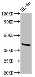 Western Blot  | Positive WB detected in: HL60 whole cell lysate  | All lanes: GPR32 antibody at 2.6µg/ml  | Secondary  | Goat polyclonal to rabbit IgG at 1/50000 dilution  | Predicted band size: 41 kDa  | Observed band size: 41 kDaRabbit anti-Human GPR32 Polyclonal Antibody