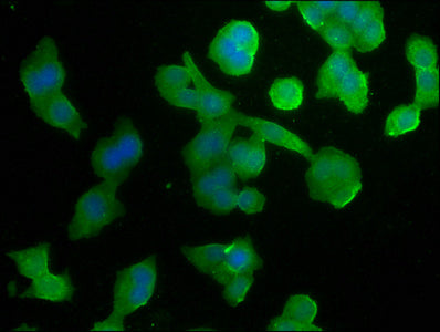 Immunofluorescence staining of PC-3 cells with GPR37 Antibody at 1:266, counter-stained with DAPI. The cells were fixed in 4% formaldehyde, permeabilized using 0.2% Triton X-100 and blocked in 10% normal Goat Serum. The cells were then incubated with the antibody overnight at 4°C. The secondary antibody was Alexa Fluor 488-congugated AffiniPure Goat Anti-Rabbit IgG(H+L).Rabbit anti-Human GPR37 Polyclonal Antibody