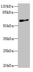 Western blot  | All lanes: GPR75 antibody at 8µg/ml + HT29 whole cell lysate  | Secondary  | Goat polyclonal to rabbit IgG at 1/10000 dilution  | Predicted band size: 59 kDa  | Observed band size: 59 kDaRabbit anti-Human GPR75 Polyclonal Antibody