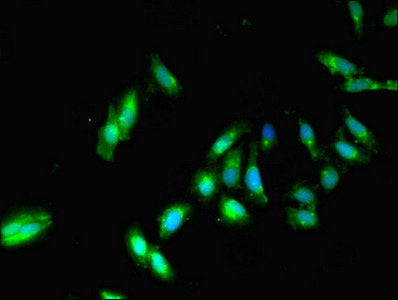 Immunofluorescent analysis of Hela cells using PPP2CB Antibody at dilution of 1:100 and Alexa Fluor 488-congugated AffiniPure Goat Anti-Rabbit IgG(H+L)Rabbit anti-Human PPP2CB Polyclonal Antibody