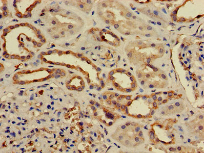 Immunohistochemistry of paraffin-embedded human kidney tissue using PPP2CB Antibody at dilution of 1:50Rabbit anti-Human PPP2CB Polyclonal Antibody