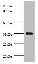 Western blot  | All lanes: Serine/threonine-protein phosphatase 2A catalytic subunit beta isoform Antibody at 2μg/ml + EC109 whole cell lysate  | Secondary  | Goat polyclonal to rabbit IgG at 1/15000 dilution  | Predicted band size: 34 kDa  | Observed band size: 34 kDaRabbit anti-Human PPP2CB Polyclonal Antibody